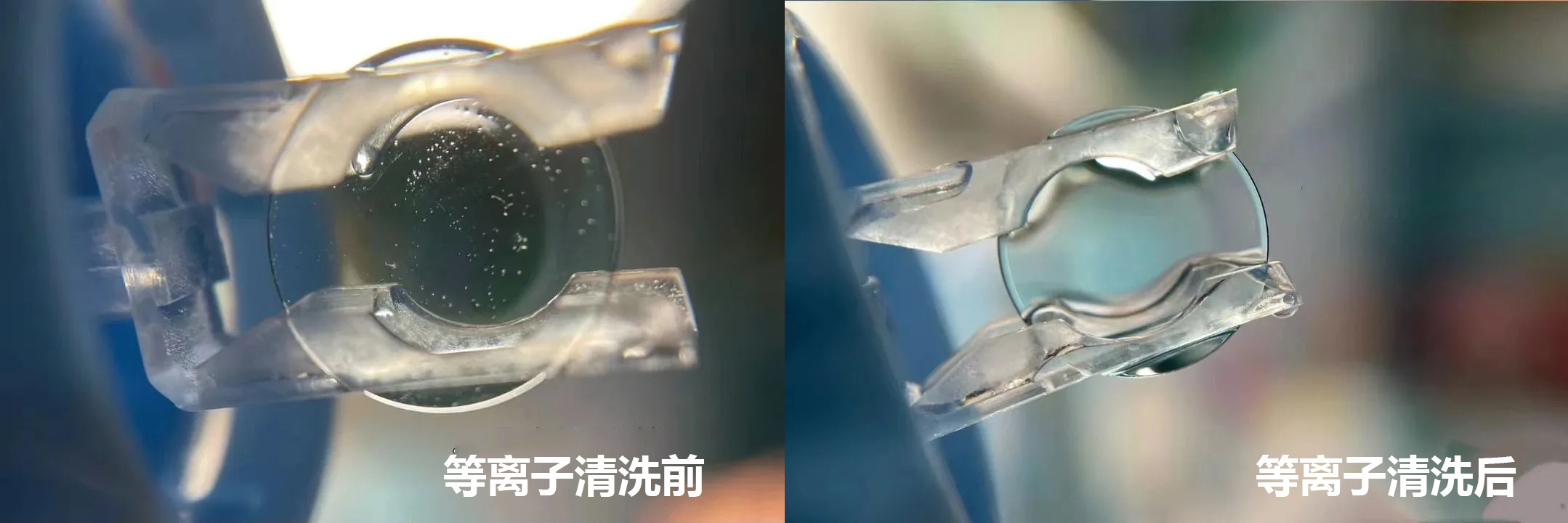 角膜塑形鏡（OK鏡）等離子清洗技術(shù)的應(yīng)用